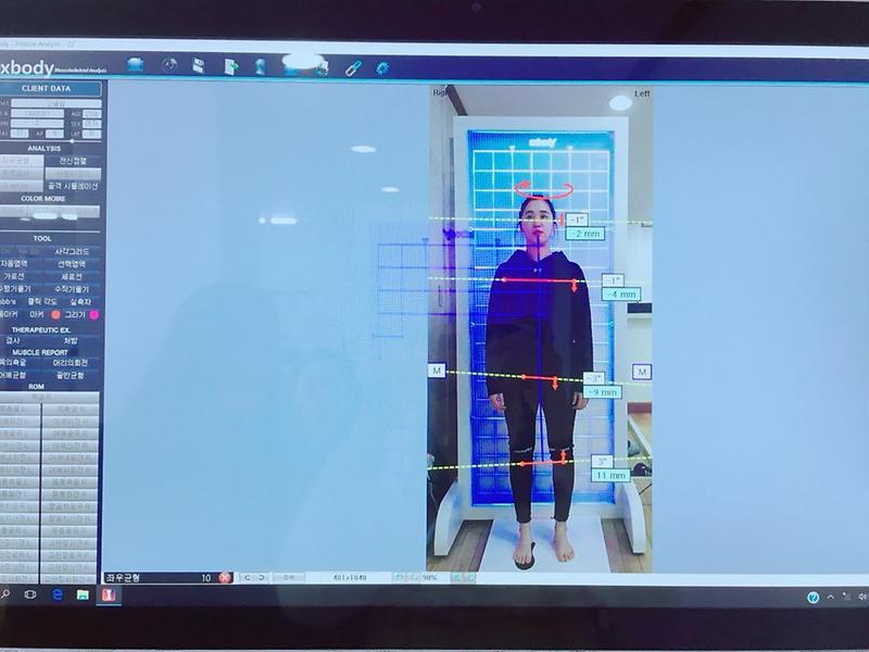 서구,_체형분석_및_바른_체형_프로그램_운영_(2).jpg 이미지